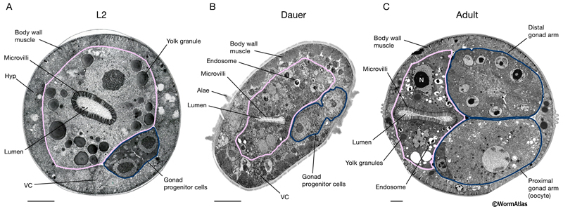 DIntFIG 2A. Midbody intestinal cells in an L2 larva, dauer larva and adult hermaphrodite.
